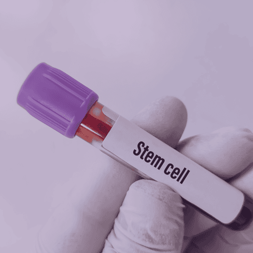 Stem Cell Treatment in Guadalajara: why US patients choose?